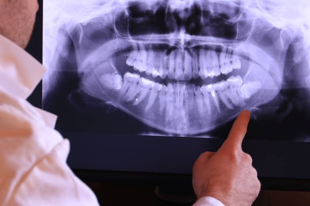 Best Dentist for Tooth Abscess  in Mexia, TX