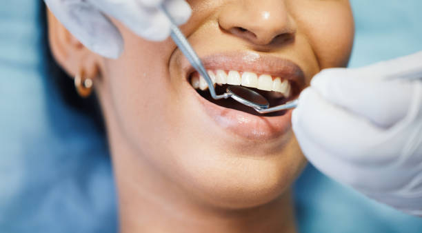 Best Emergency Tooth Extraction  in Mexia, TX