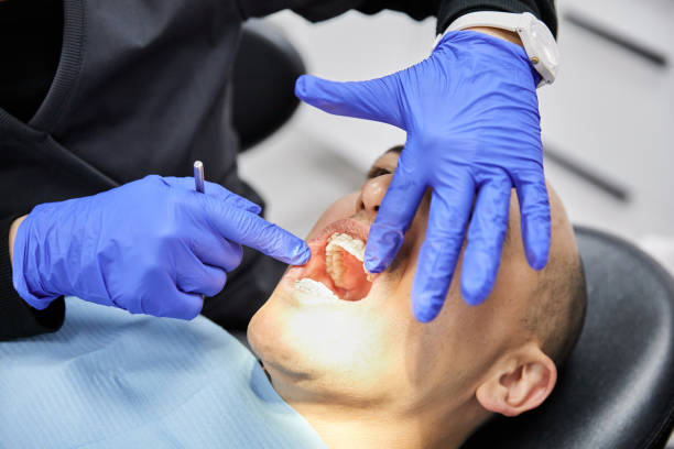 Best Teeth Whitening  in Mexia, TX